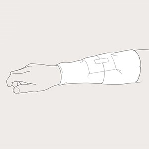 Steg 3 for applisering av Tubinette på arm