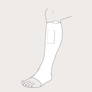 Steg 3 for applisering av Tubinette på ben